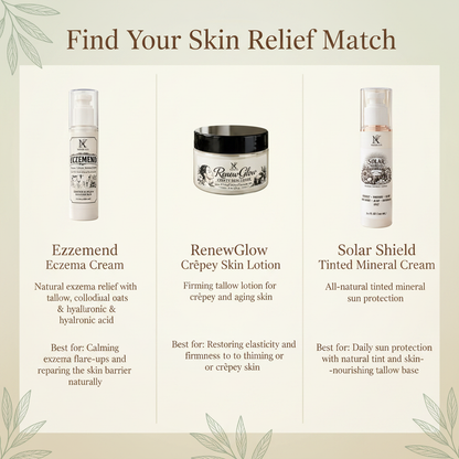 Find Your Skin Relief Match - Mama K's skin relief comparison